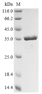 Recombinant Mannheimia haemolytica Leukotoxin (lktA), partial