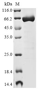 Recombinant Influenza A virus Nucleoprotein (NP) (X477S)