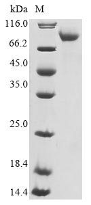 Recombinant Human Neuron navigator 1 (NAV1), partial