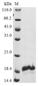 Recombinant Human Neuron navigator 1 (NAV1), partial