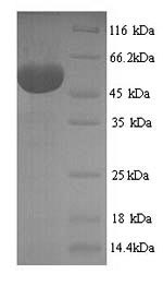 Recombinant Human Hexokinase-1 (HK1), partial