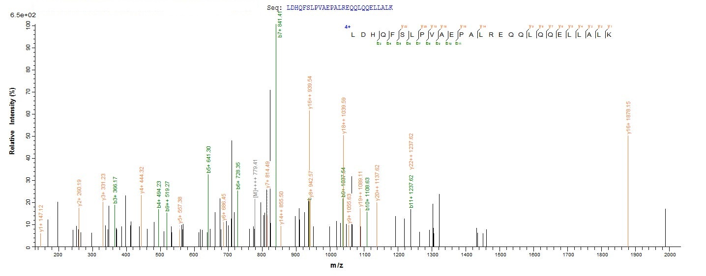 Recombinant Human Histone deacetylase 4 (HDAC4), partial