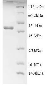 Recombinant Human Advanced glycosylation end product-specific receptor (AGER), partial