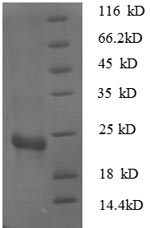 Recombinant Escherichia coli 30S ribosomal protein S7 (rpsG)