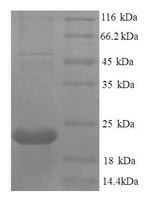 Recombinant Human Tumor necrosis factor receptor superfamily member 11A (TNFRSF11A), partial