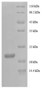 Recombinant Human Granulocyte colony-stimulating factor (CSF3), partial