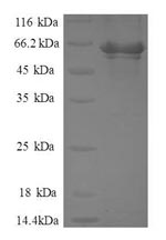 Recombinant Human Activator of 90 kDa heat shock protein ATPase homolog 1 (AHSA1)