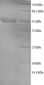Recombinant Human 40S ribosomal protein S18 (RPS18)
