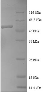 Recombinant Human Ras-related protein Rab-1A (RAB1A)