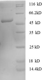 Recombinant Human Rho GDP-dissociation inhibitor 1 (ARHGDIA)