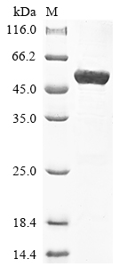 Recombinant Human Keratin,type II cytoskeletal 8 (KRT8)