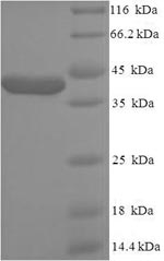 Recombinant Human ATP-sensitive inward rectifier potassium channel 10 (KCNJ10), partial