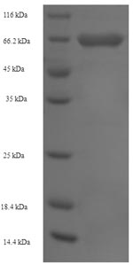 Recombinant Human Hexokinase-1 (HK1), partial