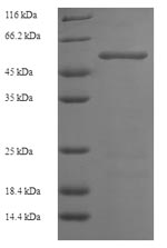 Recombinant Human Hexokinase-1 (HK1), partial