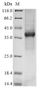 Recombinant Bovine coronavirus Spike glycoprotein (S), partial