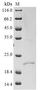 Recombinant Severe acute respiratory syndrome coronavirus 2 Envelope small membrane protein & Membrane protein (E & M), partial