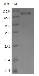 Recombinant Human Tyrosine-protein kinase receptor UFO (AXL) (D266N), partial