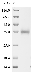 Recombinant Severe acute respiratory syndrome coronavirus Spike glycoprotein (S), partial