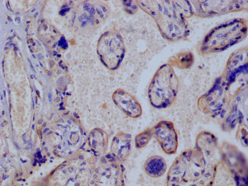 SLC2A3 Antibody