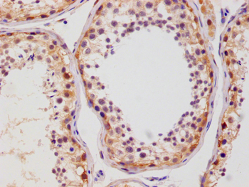 SLC2A3 Antibody
