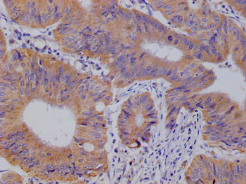 SLC2A3 Antibody