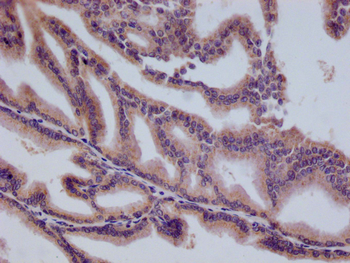 HMGCL Antibody