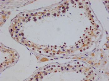 NTHL1 Antibody