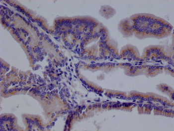 TMEM192 Antibody