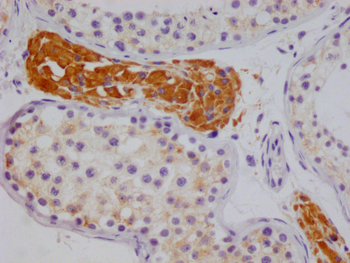 NSDHL Antibody