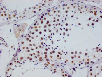 RGS6 Antibody