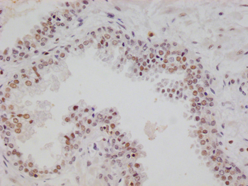 RGS6 Antibody