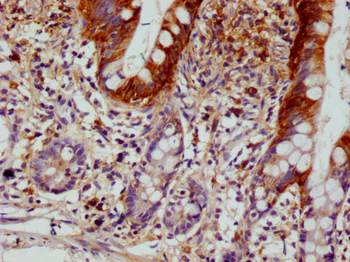 SCIN Antibody