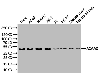 ACAA2 Antibody
