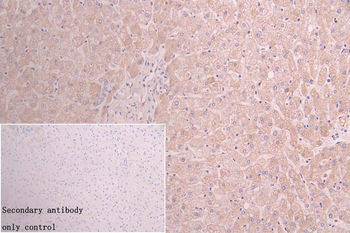 ACAA2 Antibody