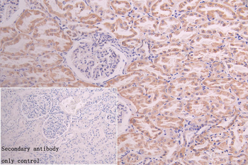 ACAA2 Antibody