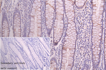 ACAA2 Antibody