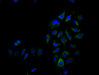 ACAA2 Antibody