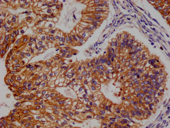 FADS1 Antibody