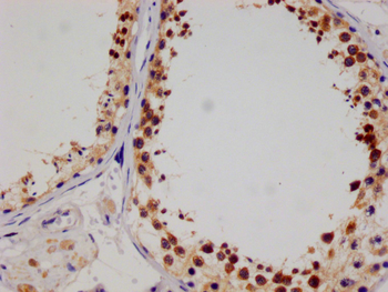 SENP1 Antibody