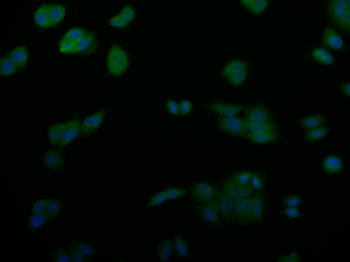 SENP1 Antibody