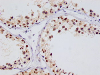 HIF1AN Antibody