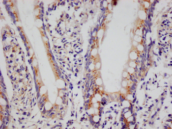 PSME1 Antibody