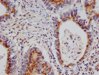 PSME1 Antibody