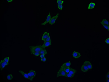 ACO1 Antibody