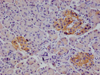 ALCAM Antibody