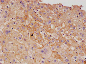 ALCAM Antibody