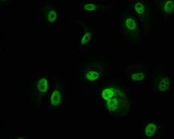 PKN2 Antibody
