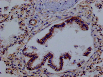 PRDX3 Antibody