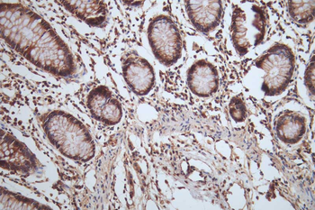 HSP90AB1 Antibody