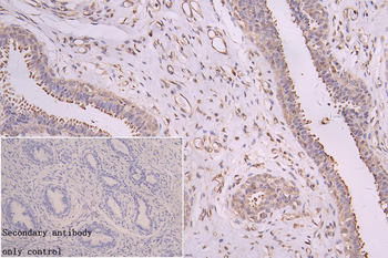YWHAB Antibody